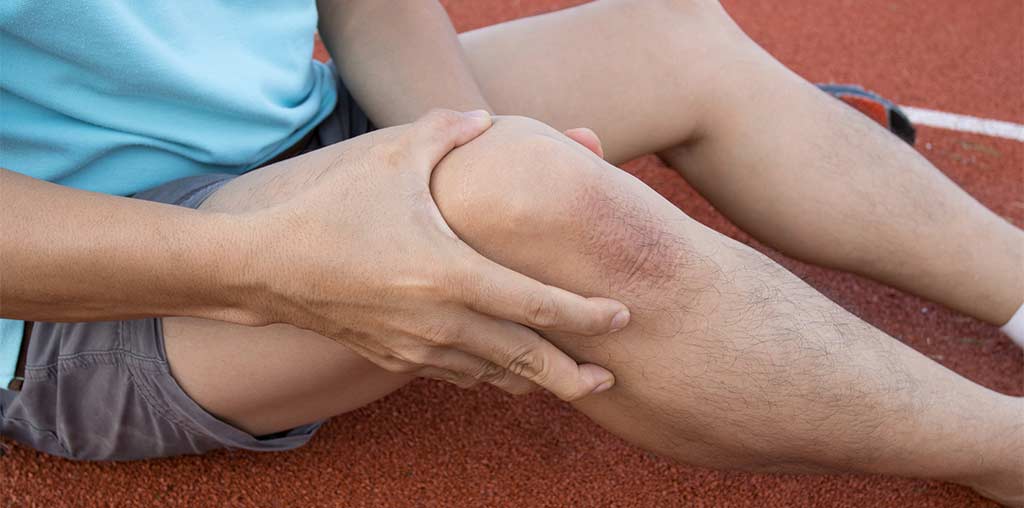 A runner clutches an injured knee after falling
